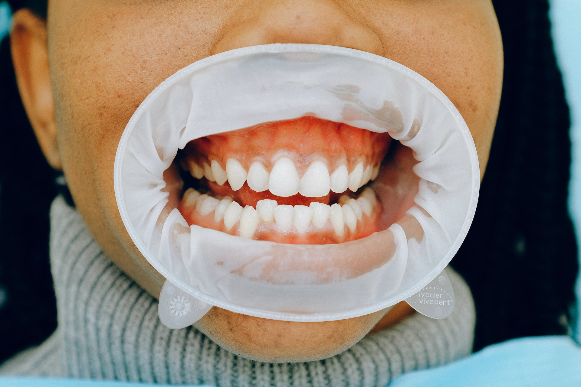 teeth